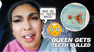 QUEEN GETS HER WISDOM TEETH REMOVED..