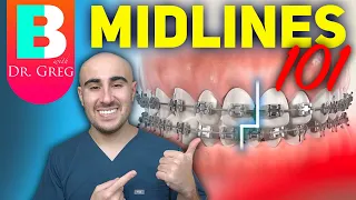 Braces Midlines 101 - Elastics, IPR, Coils and more!