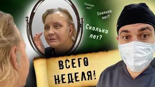 Омоложение лица: до и после