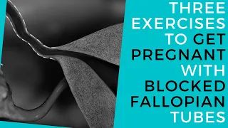 Three Exercises To Get Pregnant With Blocked Fallopian Tubes  (Without Surgery)