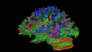 Networks in the brain: mapping the connectome