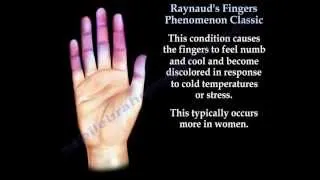 Raynaud's Fingers Phenomenon classic - Everything You Need To Know - Dr. Nabil Ebraheim