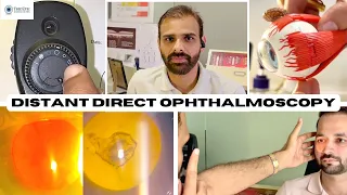 Distant Direct Ophthalmoscopy