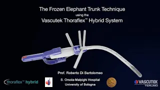 Thoraflex Implant (Dissection)