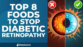 Top 8 Foods To Stop Diabetic Retinopathy