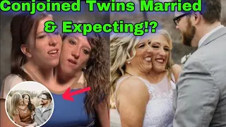 Big shocking news. Now That Conjoined Twin Abby Hensel Is Married, What Is Brittany Hensel Up To?