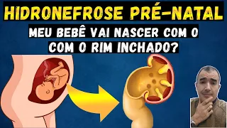 HIDRONEFROSE PRÉ-NATAL: meu bebê vai nascer com o rim inchado? Parte -1