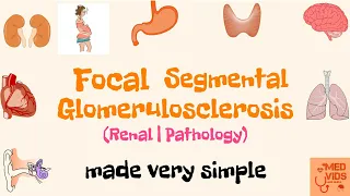 Focal Segmental Glomerulosclerosis | FSGS | Renal system | Pathology | Med Vids made simple