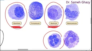 systemic pathology 44 : blood 3 ( Leukemia ) DR. SAMEH GHAZY