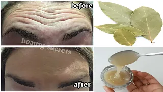 Mix bay leaves with water to look 10 years younger than your age, anti-aging remedy