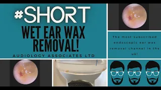 WET EAR WAX REMOVAL #SHORTS