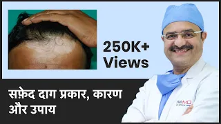 All About Vitiligo/Leucoderma (सफ़ेद दाग प्रकार, कारण और उपाय) | ClearSkin, Pune | (In HINDI)