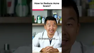 5 Ways To Reduce Acne Scars