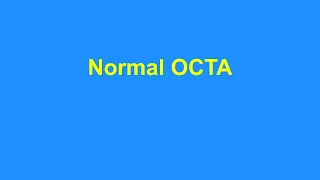 Normal OCTA
