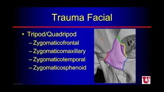 Head and Neck FMRI Wiggins Trauma Facial