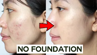 How to Cover Acne & Blemishes WITHOUT Foundation  • easy & non cakey