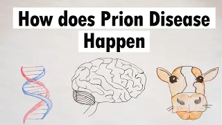 Prion Disease | How does Prion Disease Happen