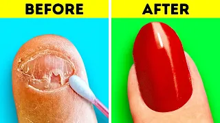 Amazing Nail Transformation || Girly Beauty Tricks