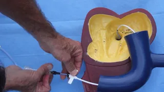 How to cannulate the CS using the Worley sheath - combined model & fluro