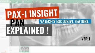 01. PaX i insight Navi Ver.1