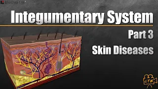 Integumentary System Part 3 (Part 3 Of 3) (Skin Diseases)