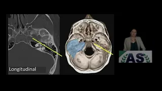 Maxillofacial Trauma | 15 Minute Radiology CME