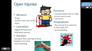 EMS Lecture - Soft Tissue Injuries: BURNS, AVPU & SAMPLE