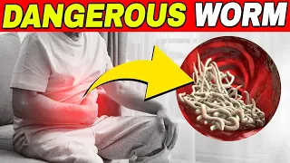 Eradicate the Worms - 7 Foods That Obliterate Intestinal Parasites!