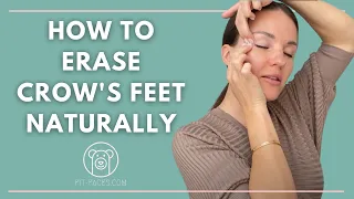 How to get rid of Crow's feet Naturally