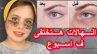 اسهل  5 طرق لعلاج الهالات السوداء/تجنبى هذه العادات اليوميه(هى سبب الهالات)❌