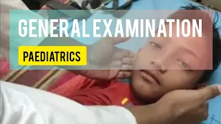 general examination paediatrics | paediatrics ward | general examination | @sanowarhossain1290