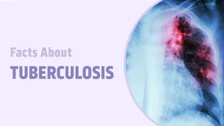 Facts about Tuberculosis | Diseases Decoded | NEET SS 2.0