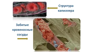 NAYUTA Инфаркты, Инсульты и многое другое побеждены!  Как применять и зачем Nayutachion Наюты