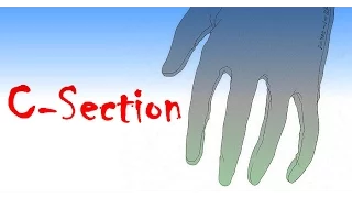 Horror Short Story: C-Section