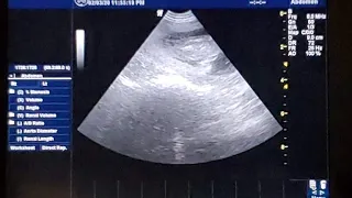 Breeding 2: CONFIRMING PREGNANCY BY ULTRASOUND ~week by week in utero development.