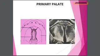 Development of Palate Embryology Dr Shabana Lectures