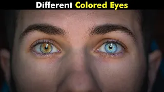 Heterochromia - Different Colored Eyes (Urdu/Hindi)