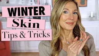 DRY Winter SKIN Tips! These SAVED My Skin! Body + Face!