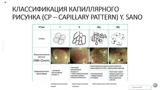 Диагностика небольших образований толстой кишки. Роль подготовки толстой кишки к исследованию.