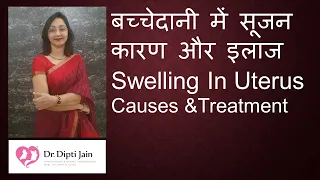 बच्चेदानी में सूजन - कारण और इलाज SWELLING IN UTERUS - Causes & Treatment