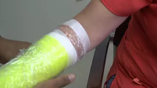 How to Shower with a Cast or Splint