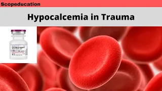 Hypocalcemia in Trauma