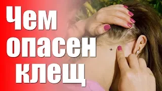 ЧЕМ ОПАСЕН КЛЕЩ.ОПАСНОСТЬ УКУСА КЛЕЩА ДЛЯ ЧЕЛОВЕКА