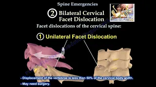 Spine Emergencies - Everything You Need To Know - Dr. Nabil Ebraheim