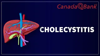 Cholecystitis