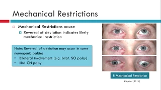 Deviations in Incomitant Strabismus