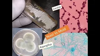 Study of fungi  || Yeast and mold