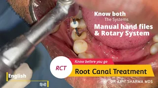 How Root canal  treatment / RCT is done ? Know both Manual and Rotary system