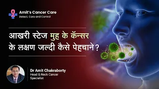 आखरी स्टेज मुह के कॅन्सर के लक्षण जल्दी कैसे पेहचाने? | Last Stage Oral Cancer Symptoms | Dr. Amit