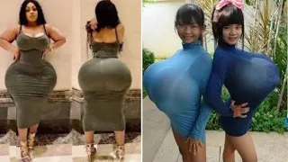 10 People With Unusual Largest Body Parts In The World